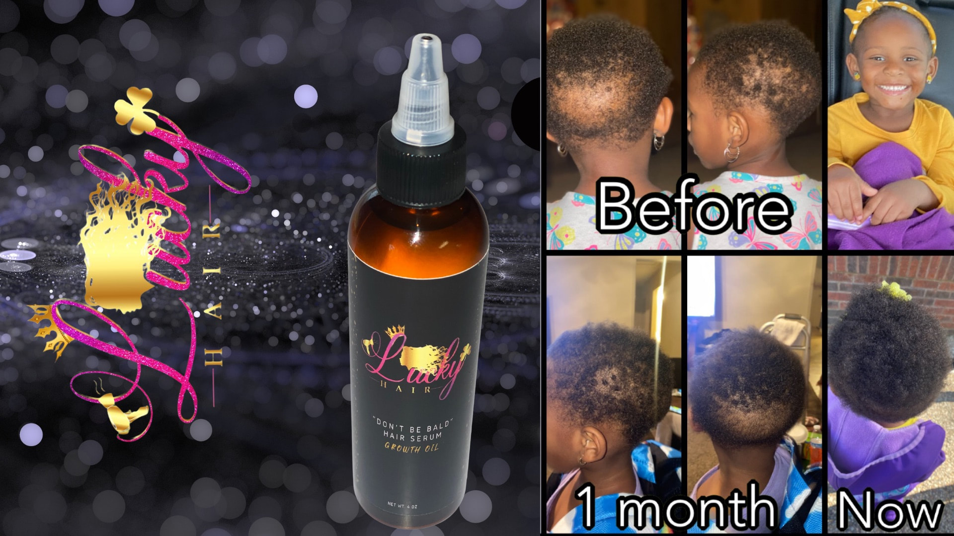 Say Goodbye to Bald Spots with 7 Day Ginger Germinal Hair Growth Essence Oil